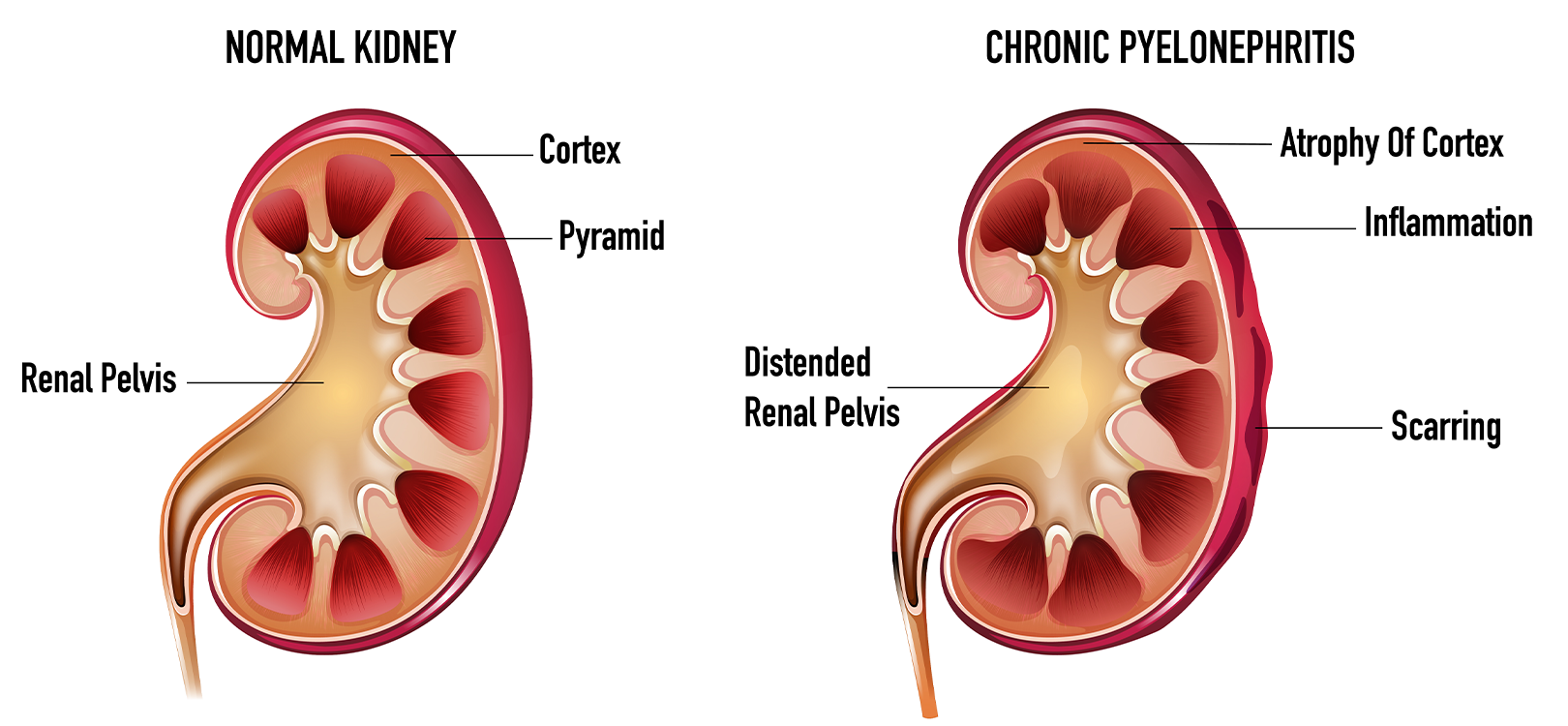 Nephrology